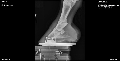 Left Forefoot Lateral